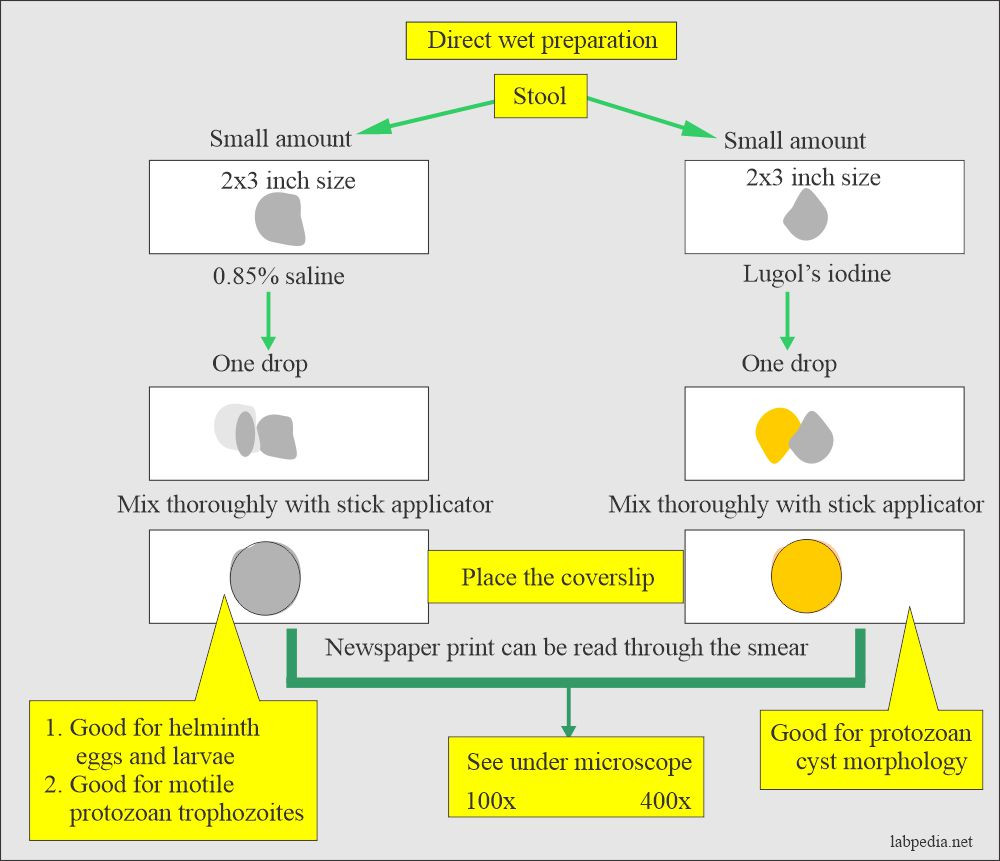 Process Stool Samples In Lab Resume Stool Examination:- Part 2 – Stool Smear Preparation, Stains …